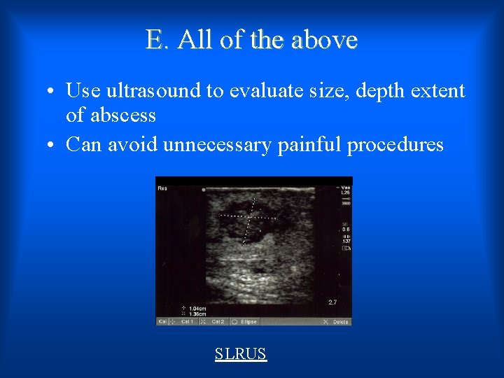 E. All of the above • Use ultrasound to evaluate size, depth extent of