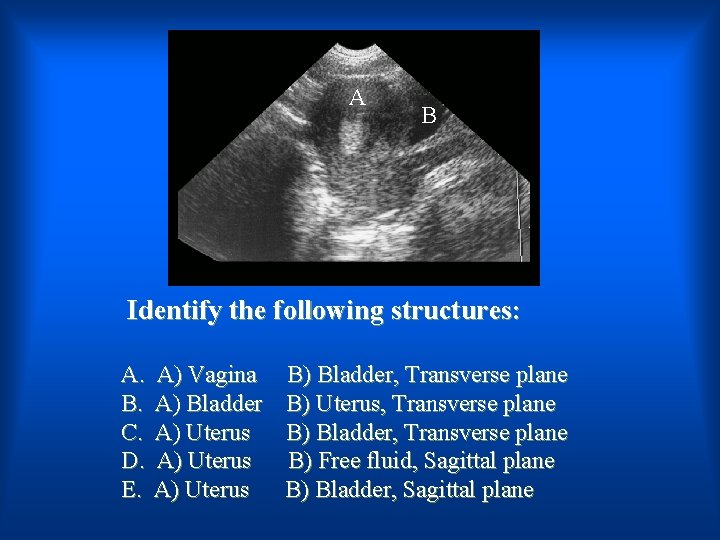 A B Identify the following structures: A. B. C. D. E. A) Vagina A)