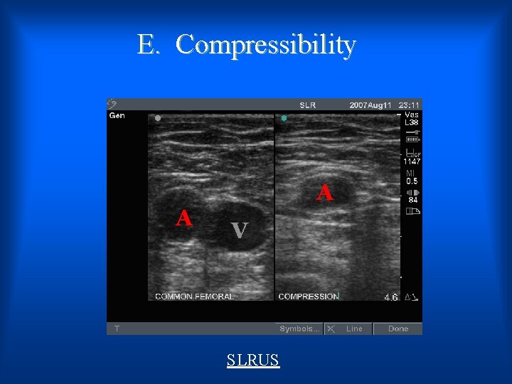 E. Compressibility A A V SLRUS 