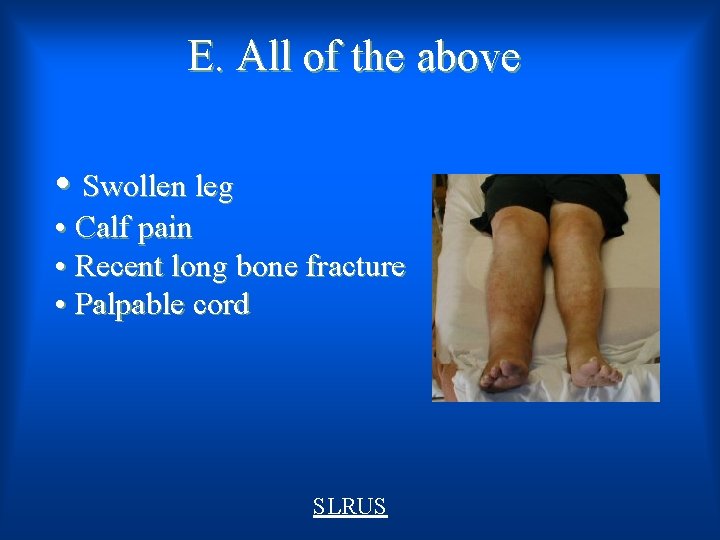 E. All of the above • Swollen leg • Calf pain • Recent long