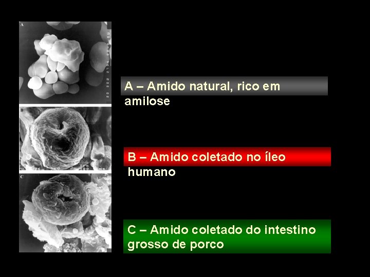 A – Amido natural, rico em amilose B – Amido coletado no íleo humano