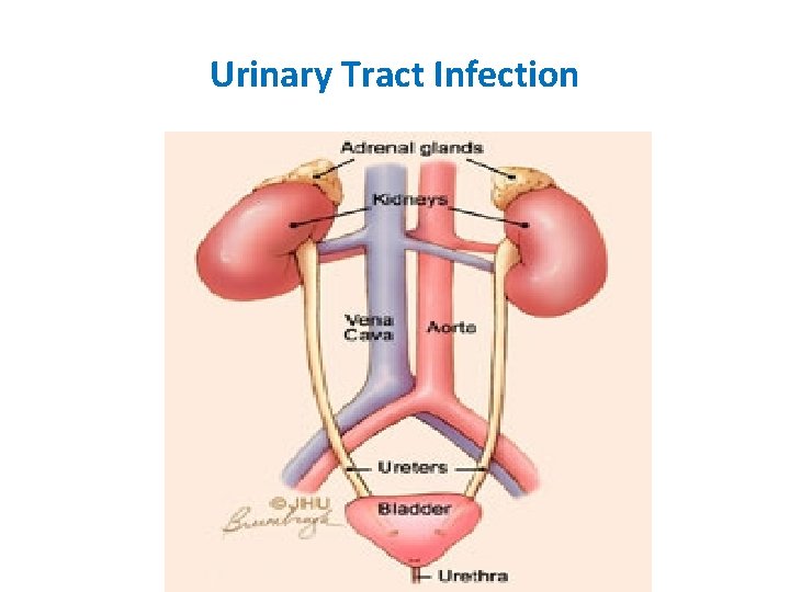 Urinary Tract Infection 