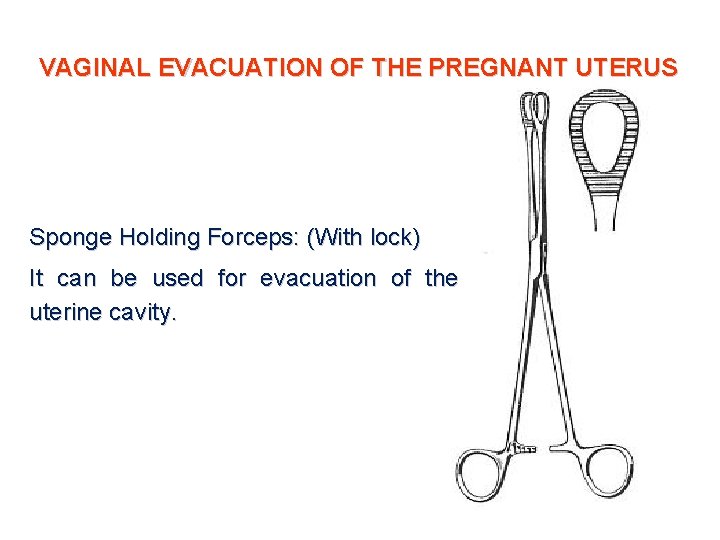 VAGINAL EVACUATION OF THE PREGNANT UTERUS Sponge Holding Forceps: (With lock) It can be