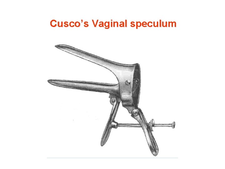 Cusco’s Vaginal speculum 