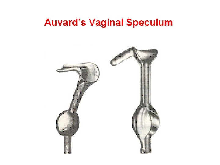 Auvard’s Vaginal Speculum 