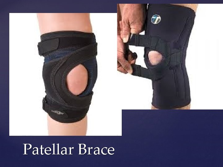 Patellar Brace 