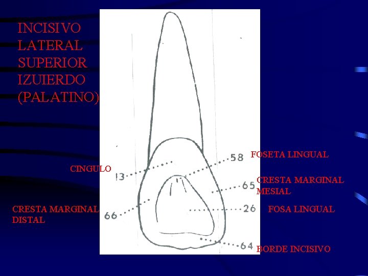 INCISIVO LATERAL SUPERIOR IZUIERDO (PALATINO) FOSETA LINGUAL CINGULO CRESTA MARGINAL MESIAL CRESTA MARGINAL DISTAL