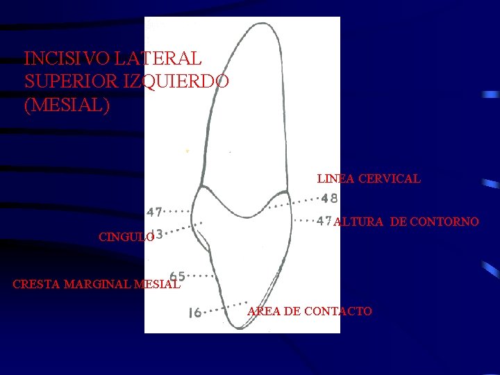 INCISIVO LATERAL SUPERIOR IZQUIERDO (MESIAL) LINEA CERVICAL ALTURA DE CONTORNO CINGULO CRESTA MARGINAL MESIAL