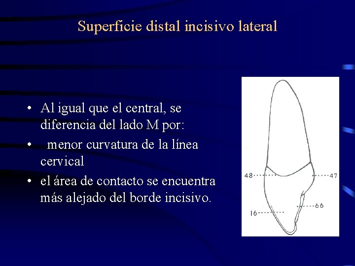 Superficie distal incisivo lateral • Al igual que el central, se diferencia del lado