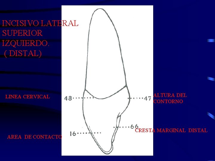 INCISIVO LATERAL SUPERIOR IZQUIERDO. ( DISTAL) LINEA CERVICAL ALTURA DEL CONTORNO CRESTA MARGINAL DISTAL