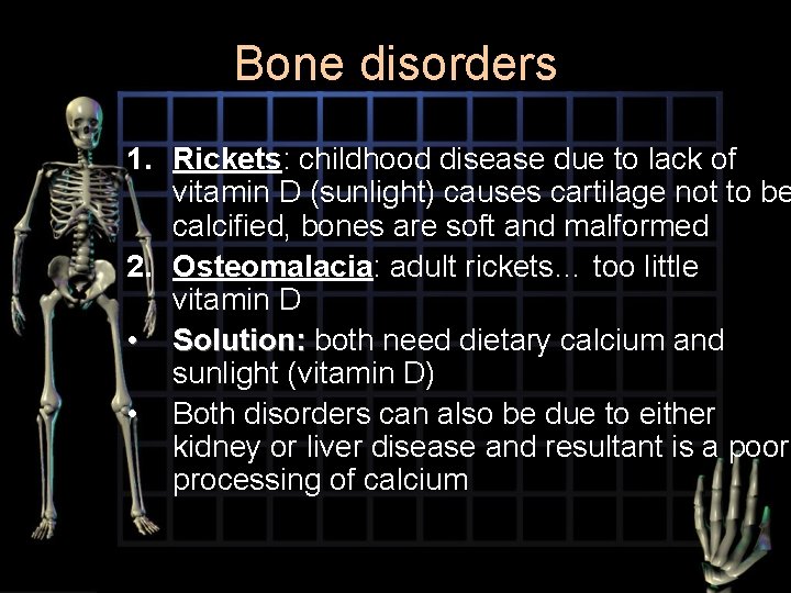 Bone disorders 1. Rickets: childhood disease due to lack of vitamin D (sunlight) causes
