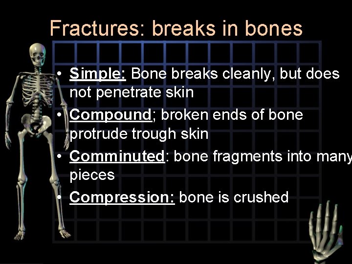 Fractures: breaks in bones • Simple: Bone breaks cleanly, but does not penetrate skin