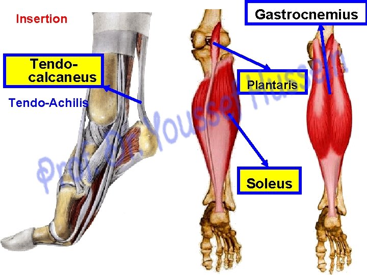 Insertion Tendocalcaneus Gastrocnemius Plantaris Tendo-Achilis Soleus 