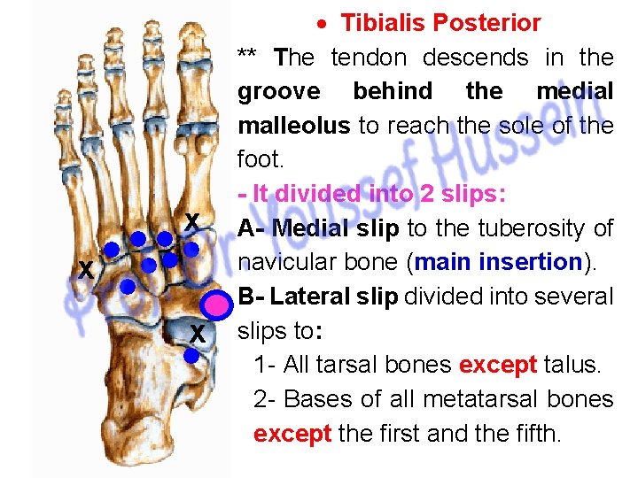 x x x Tibialis Posterior ** The tendon descends in the groove behind the