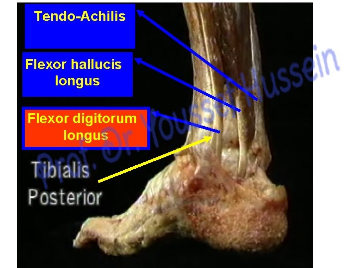 Tendo-Achilis Flexor hallucis longus Flexor digitorum longus 