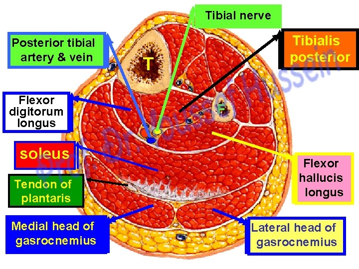 Tibial nerve Posterior tibial artery & vein Flexor digitorum longus soleus Tendon of plantaris