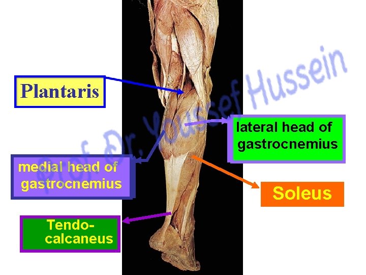 Plantaris lateral head of gastrocnemius medial head of gastrocnemius Tendocalcaneus Soleus 