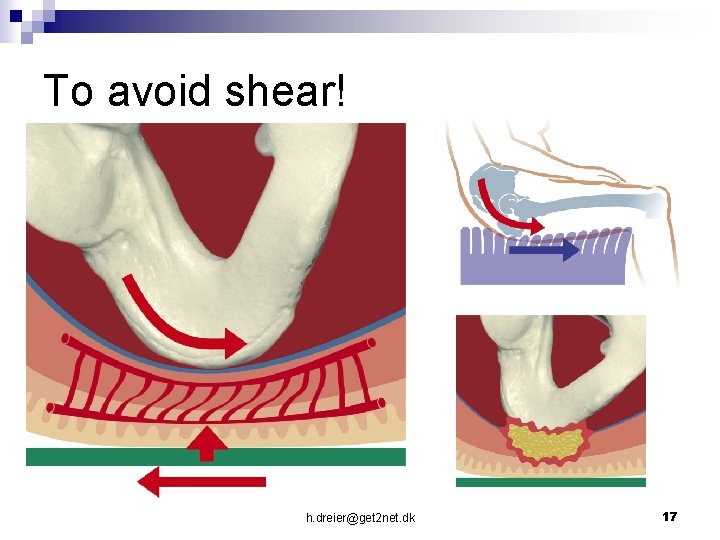 To avoid shear! h. dreier@get 2 net. dk 17 