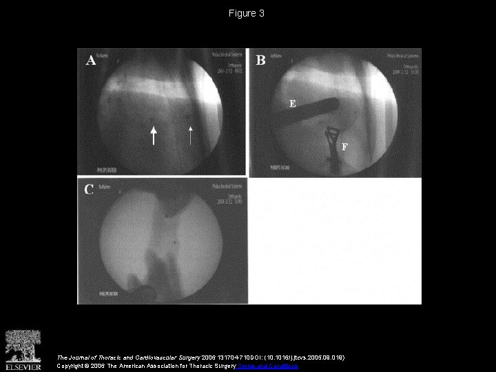 Figure 3 The Journal of Thoracic and Cardiovascular Surgery 2006 131704 -710 DOI: (10.