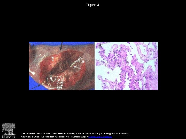 Figure 4 The Journal of Thoracic and Cardiovascular Surgery 2006 131704 -710 DOI: (10.