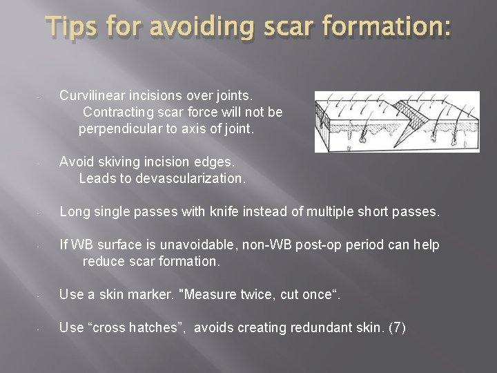 Tips for avoiding scar formation: - Curvilinear incisions over joints. Contracting scar force will