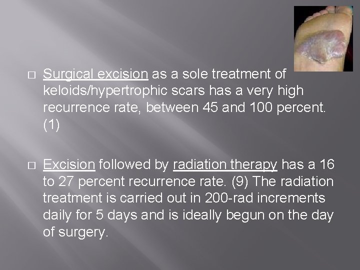 � Surgical excision as a sole treatment of keloids/hypertrophic scars has a very high