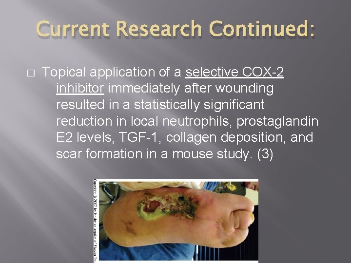 Current Research Continued: � Topical application of a selective COX-2 inhibitor immediately after wounding