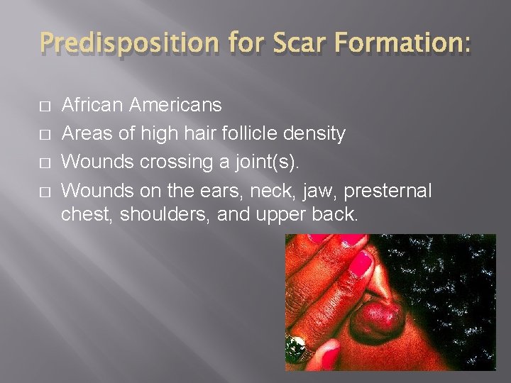 Predisposition for Scar Formation: � � African Americans Areas of high hair follicle density