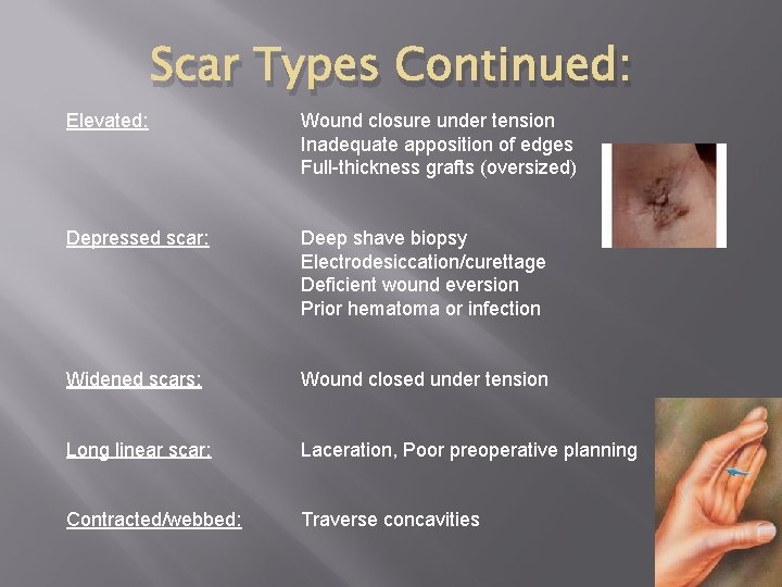 Scar Types Continued: Elevated: Wound closure under tension Inadequate apposition of edges Full-thickness grafts