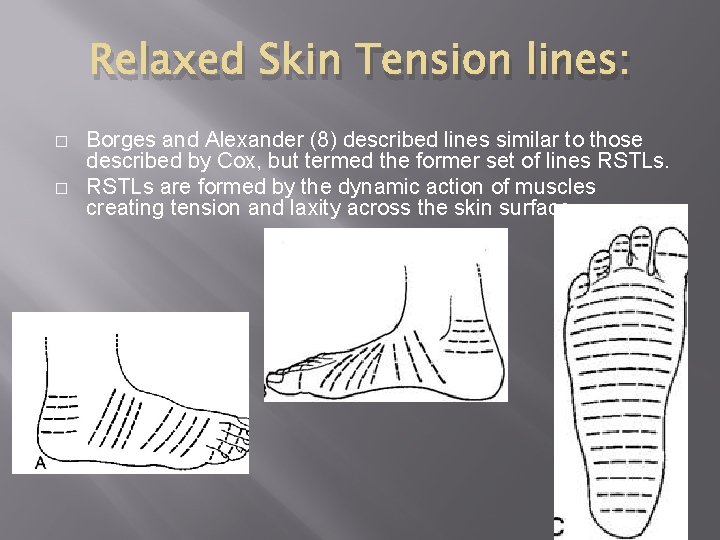 Relaxed Skin Tension lines: � � Borges and Alexander (8) described lines similar to