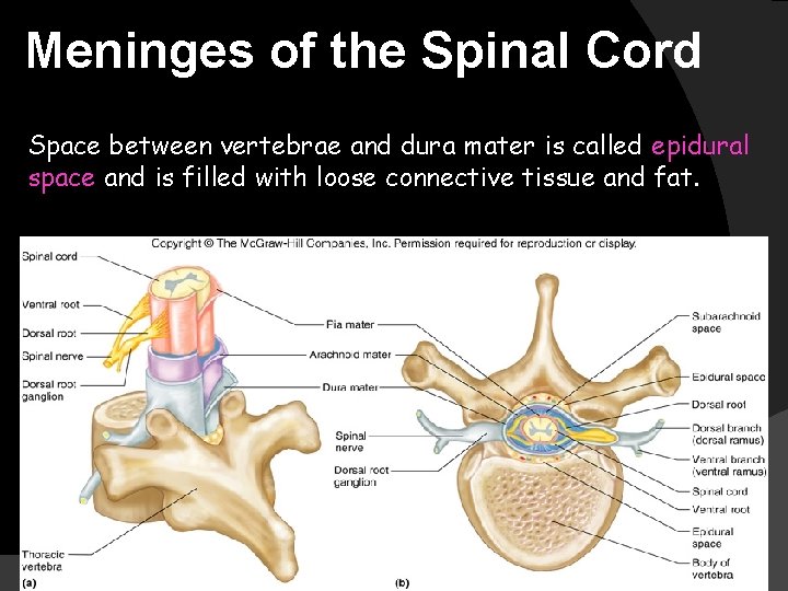 Meninges of the Spinal Cord Space between vertebrae and dura mater is called epidural