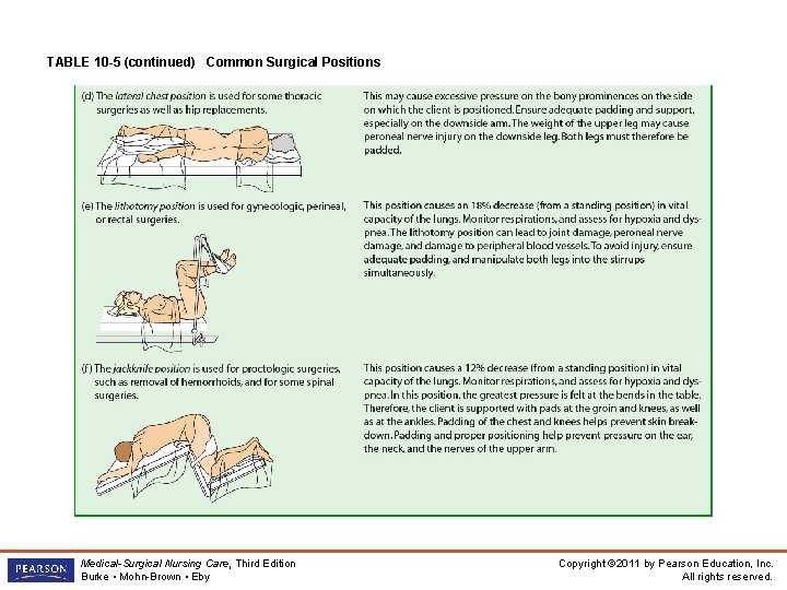 TABLE 10 -5 (continued) Common Surgical Positions Medical-Surgical Nursing Care, Third Edition Burke •