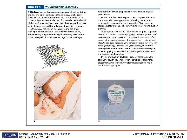 Medical-Surgical Nursing Care, Third Edition Burke • Mohn-Brown • Eby Copyright © 2011 by