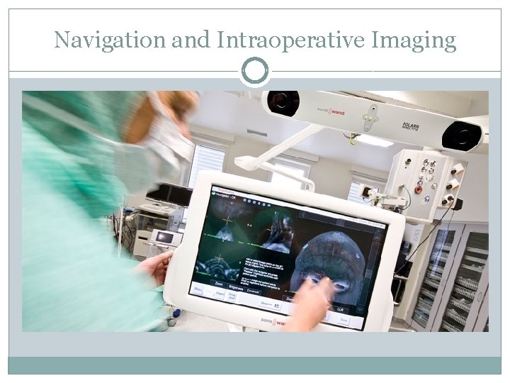 Navigation and Intraoperative Imaging 
