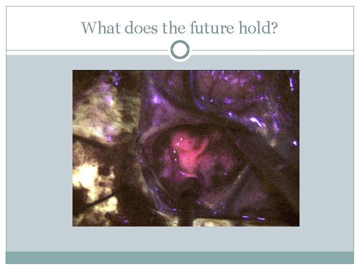 What does the future hold? 