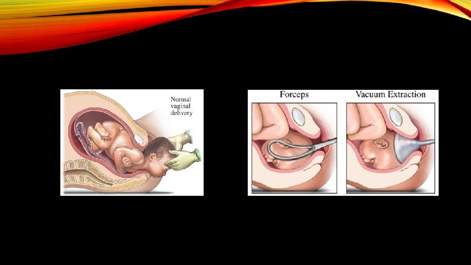 BIRTHING TYPES By Travis Bren Christian INTRODUCTION The
