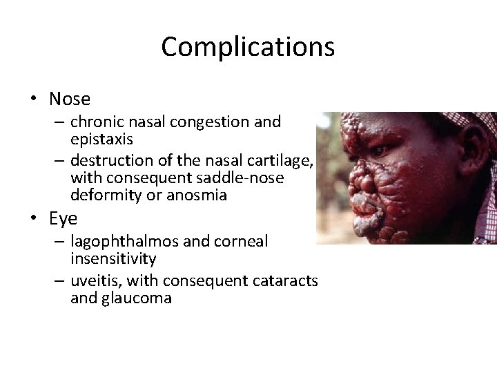 Complications • Nose – chronic nasal congestion and epistaxis – destruction of the nasal