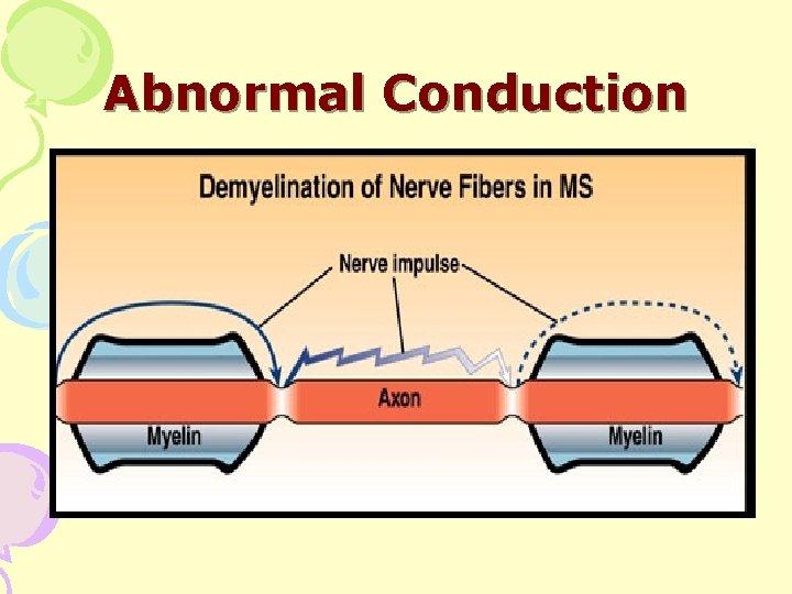 Abnormal Conduction 