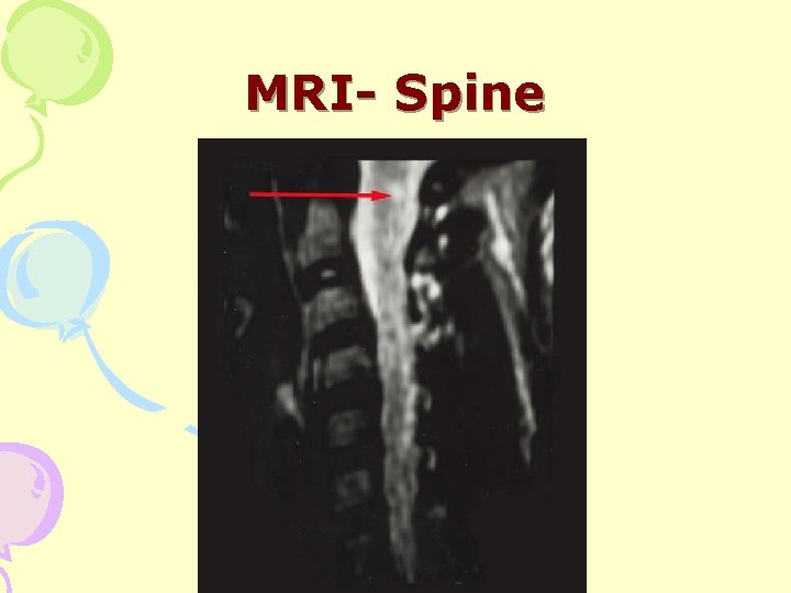 MRI- Spine 