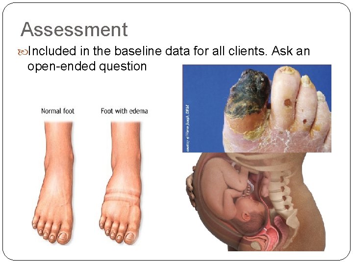 Assessment Included in the baseline data for all clients. Ask an open-ended question 