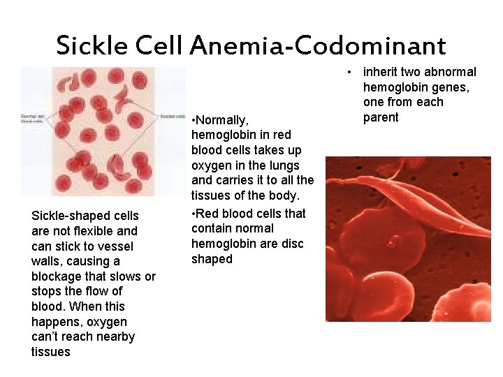 Sickle Cell Anemia-Codominant Sickle-shaped cells are not flexible and can stick to vessel walls,