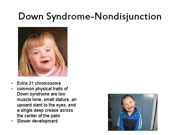 Down Syndrome-Nondisjunction • Extra 21 chromosome • common physical traits of Down syndrome are