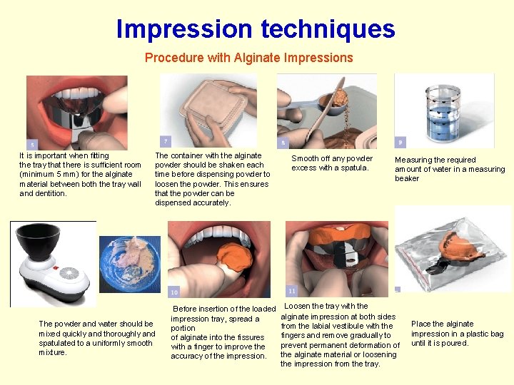 Impression techniques Procedure with Alginate Impressions It is important when fitting the tray that Impression techniques Procedure with Alginate Impressions It is important when fitting the tray that