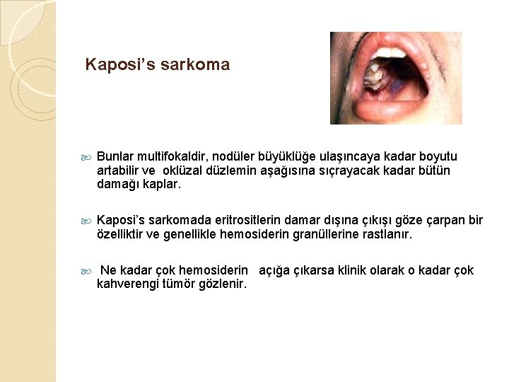 Kaposi’s sarkoma Bunlar multifokaldir, nodüler büyüklüğe ulaşıncaya kadar boyutu artabilir ve oklüzal düzlemin aşağısına