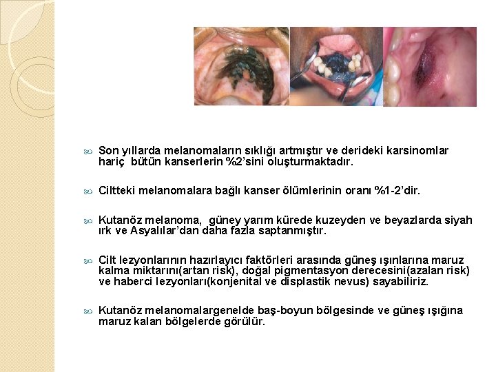  Son yıllarda melanomaların sıklığı artmıştır ve derideki karsinomlar hariç bütün kanserlerin %2’sini oluşturmaktadır.