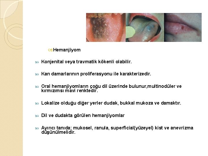  Hemanjiyom Konjenital veya travmatik kökenli olabilir. Kan damarlarının proliferasyonu ile karakterizedir. Oral hemanjiyomların