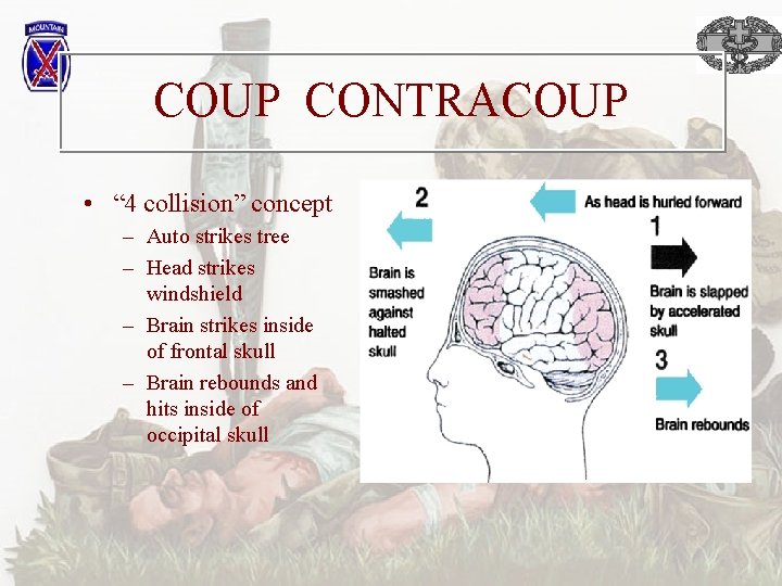 COUP CONTRACOUP • “ 4 collision” concept – Auto strikes tree – Head strikes