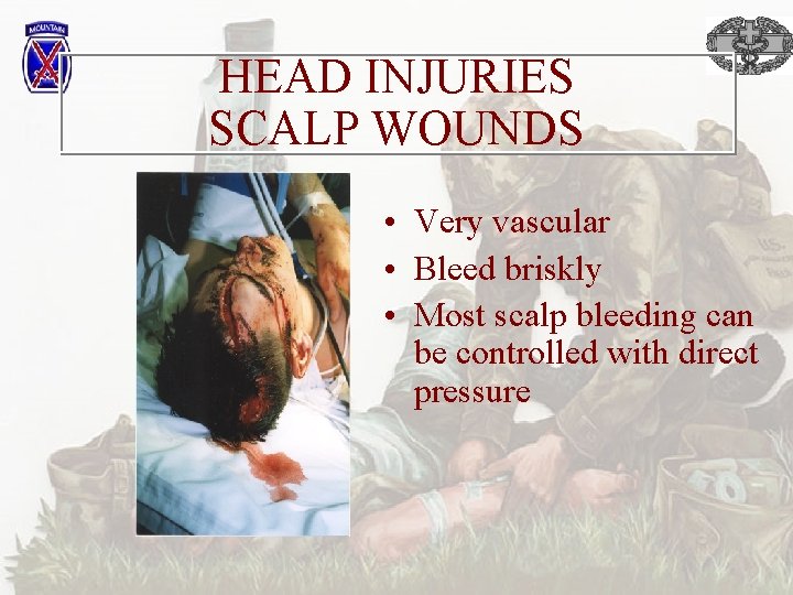 HEAD INJURIES SCALP WOUNDS • Very vascular • Bleed briskly • Most scalp bleeding