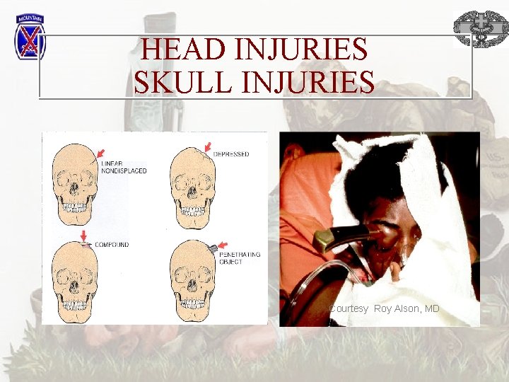 HEAD INJURIES SKULL INJURIES Courtesy Roy Alson, MD 