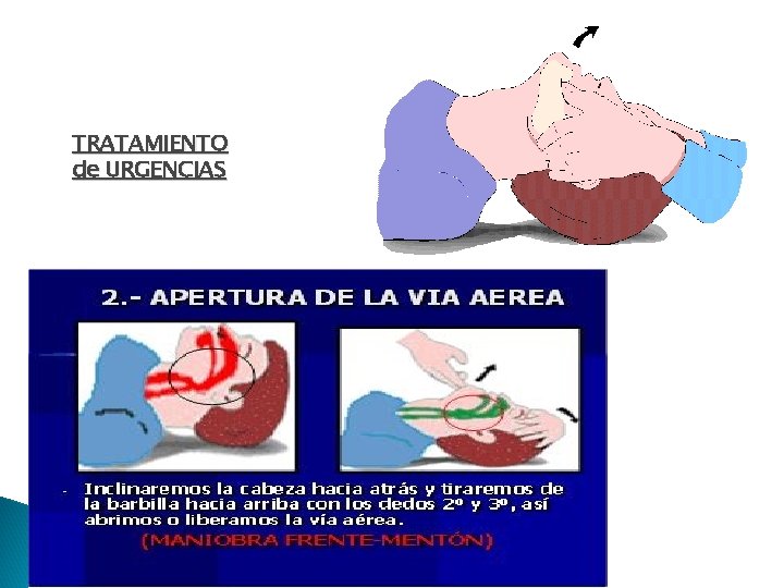 TRATAMIENTO de URGENCIAS 